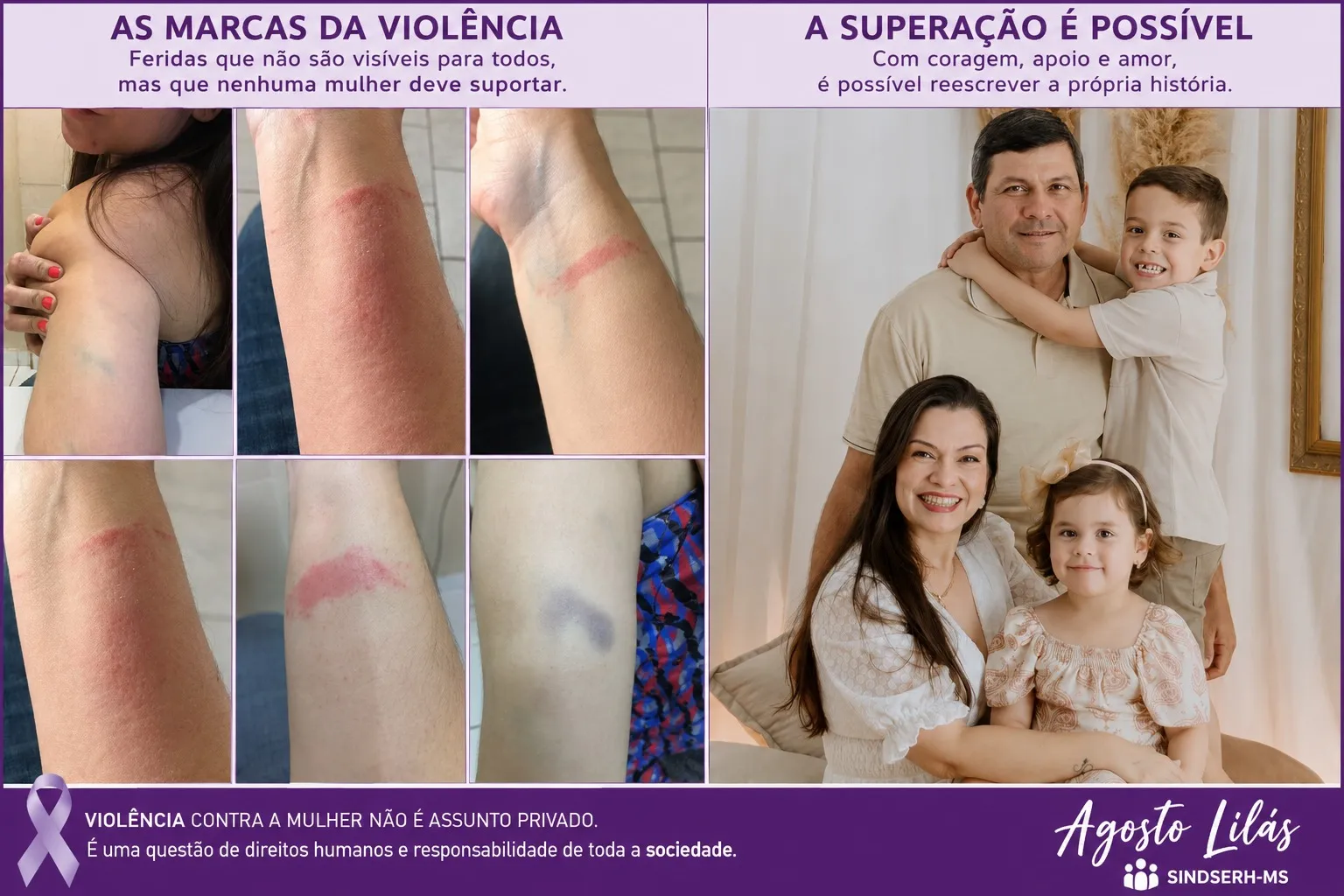 SINDSERH-MS lança a Campanha Agosto Lilás em defesa das mulheres